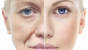 Is black seed oil good for wrinkles? Is black seed oil good for wrinkles?